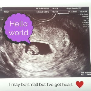 ivf-blog-mum100-7-week-ultrasound-scan-heartbeat
